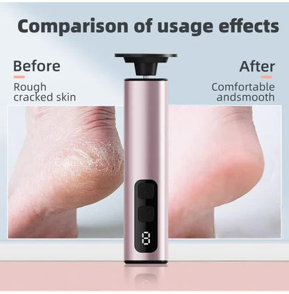 Black Rechargeable Electric Foot File with 9 Speed Settings - Callus Remover for Smooth Feet VXN Beauty