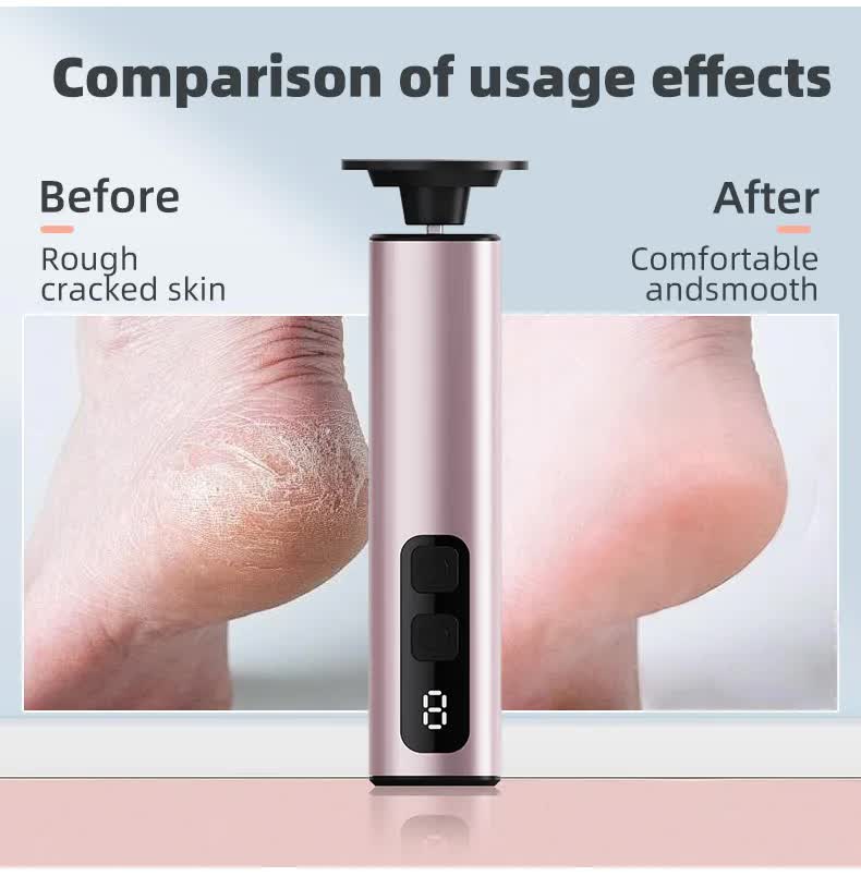 Purple Rechargeable Electric Foot File with 9 Speed Settings - Callus Remover for Smooth Feet VXN Beauty