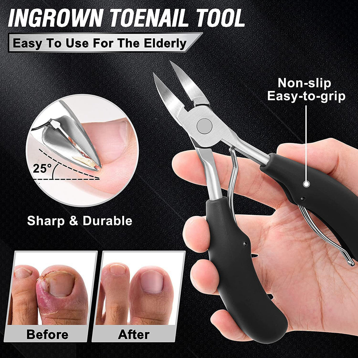 7-Piece Professional Ingrown Toenail Tool Kit - Stainless Steel Precision Pedicure Set with Black Eagle-Nose Clippers & Leather Storage Case VXN Beauty